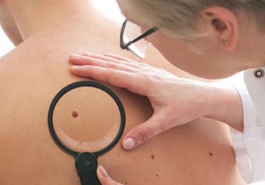 Mole inspection