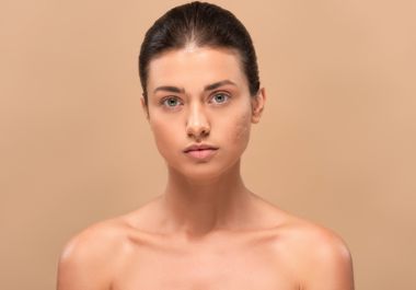 A girl with a scar in her face